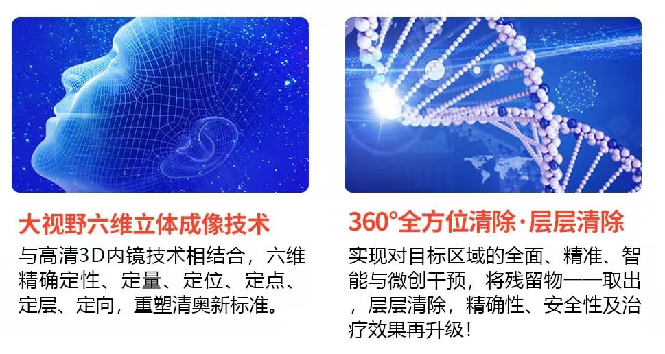 苹果肌打了奥美定如何才能取干净