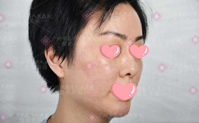 为什么生长因子不能溶解呢