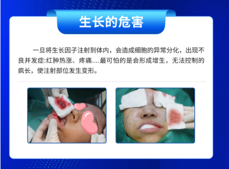 生长因子注射多久后开始疯长