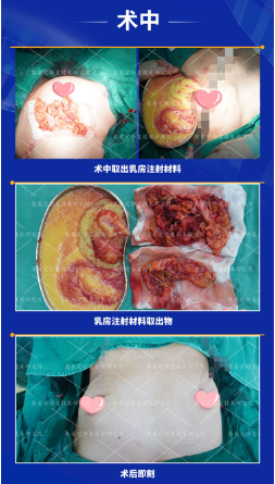 奥美定的危害和副作用有哪些？