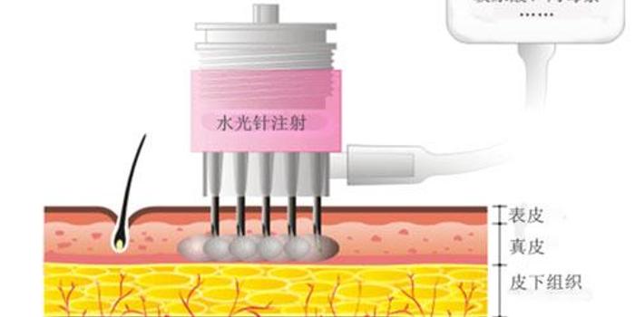 水光应该怎么选？