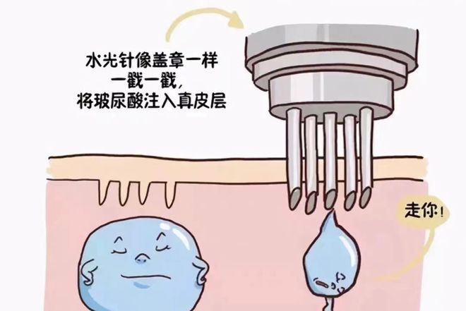  水光针的功效与作用