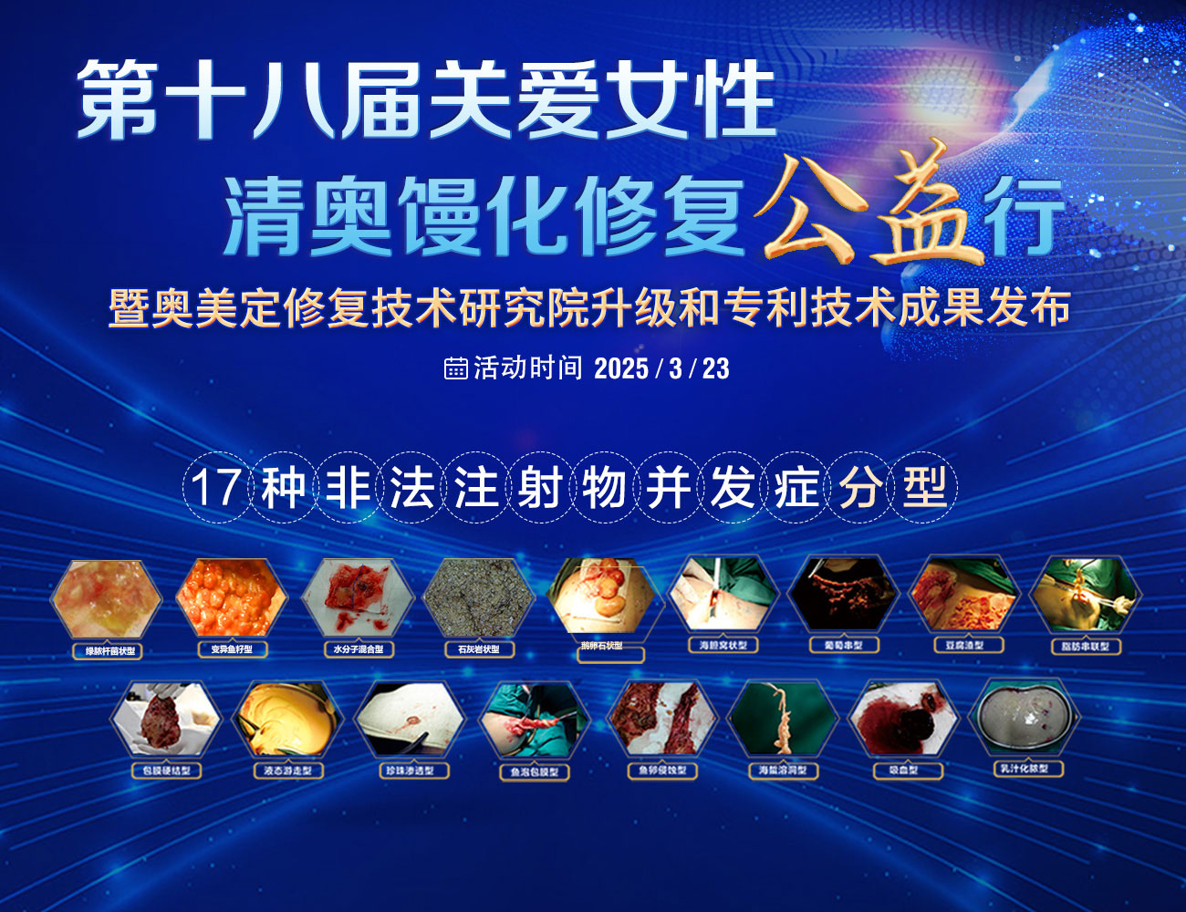 馒化脸是什么原因导致的