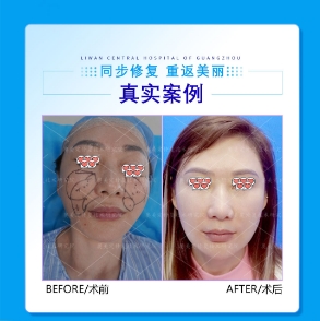 生长因子在什么情况下会刺激生长