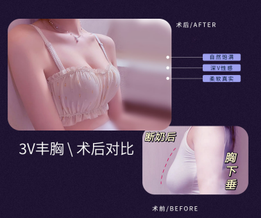 假体隆胸后，胸部多久能变柔软？一篇讲明白