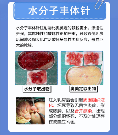 捷克水分子怎么取出