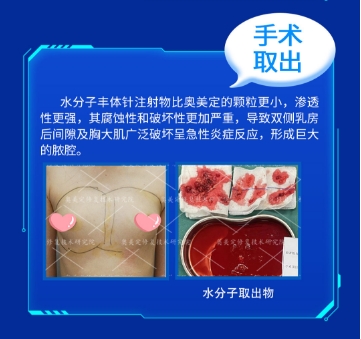捷克水分子致癌是真的吗
