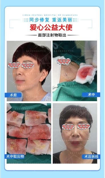 不小心打了生长因子要怎么溶解