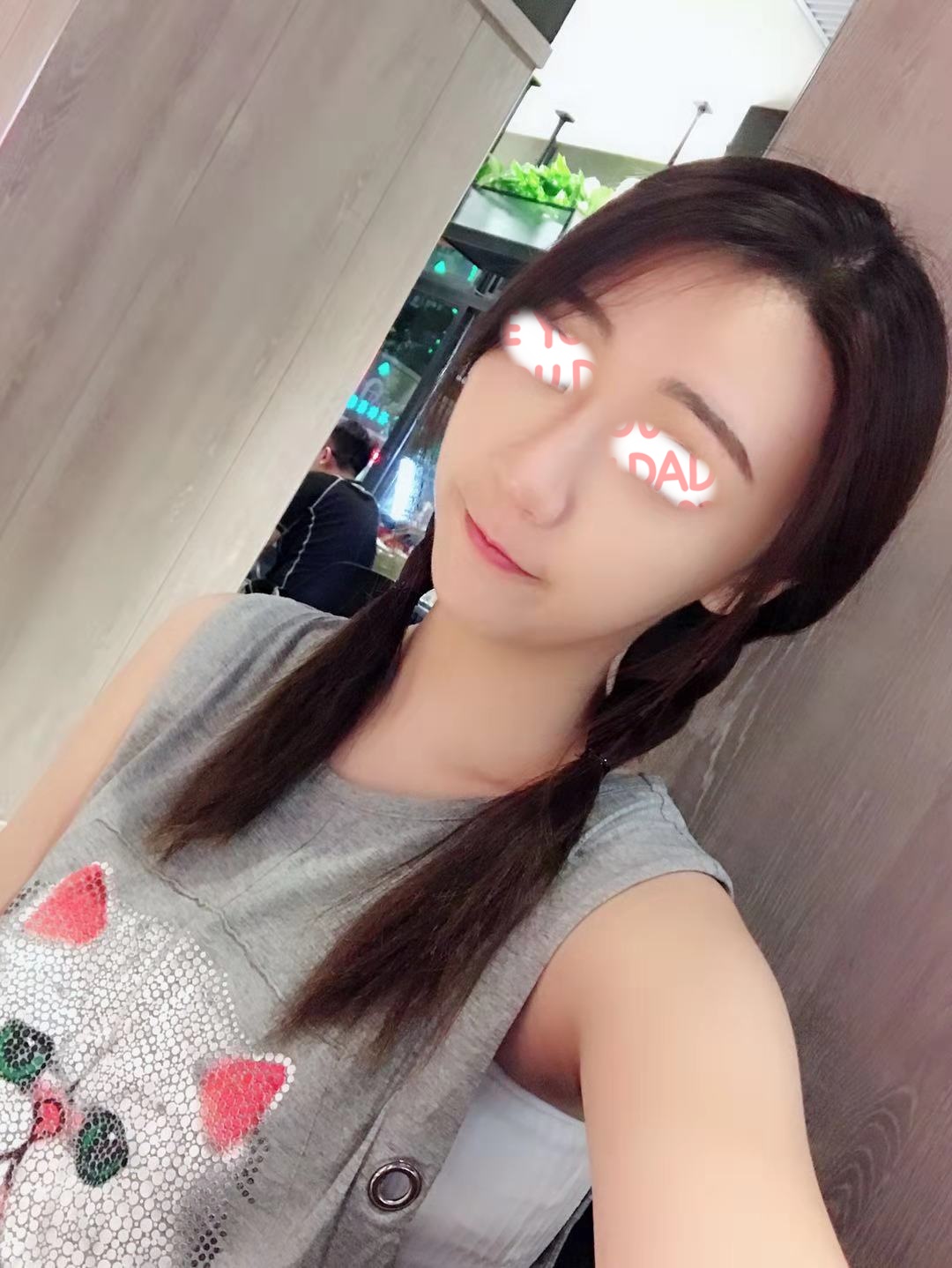  苹果肌注射生长因子，孙女士的脸变成了“发面馒头”